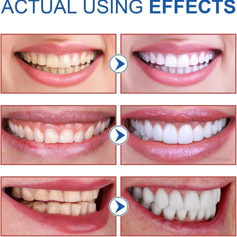 SP10 Probiotic Toothpaste